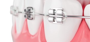 The Mental Health Benefits of a Beautiful Smile