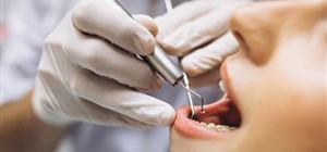 The Role of General Dentistry in Maintaining Optimal Oral Health 