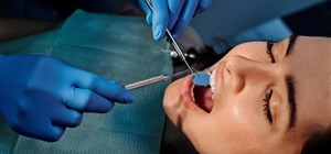 Do You Need a Root Canal? Here is Everything You Need to Know About Them