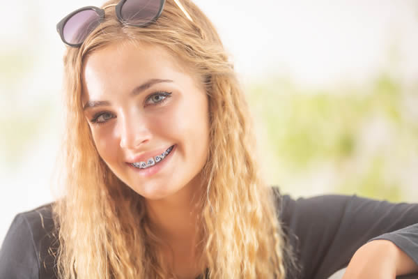 Dental Braces Dental Braces