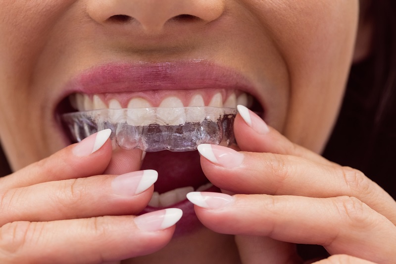 dentist in cape town