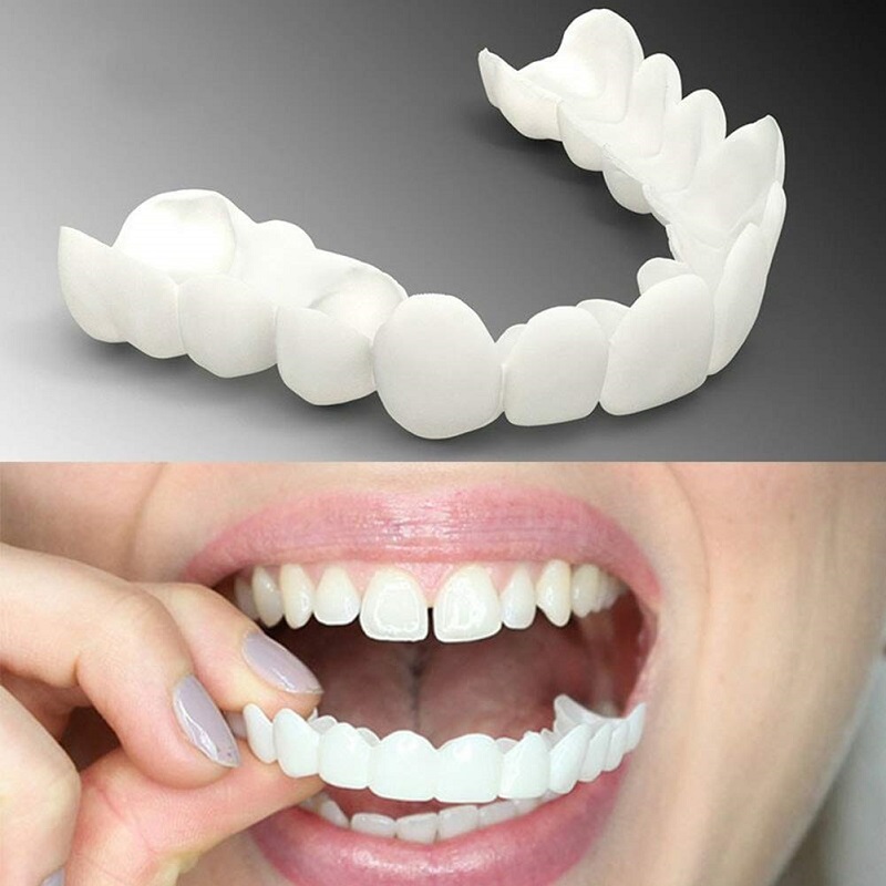 instant smile retainers