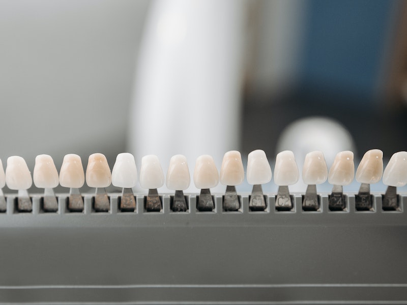 veneers procedure